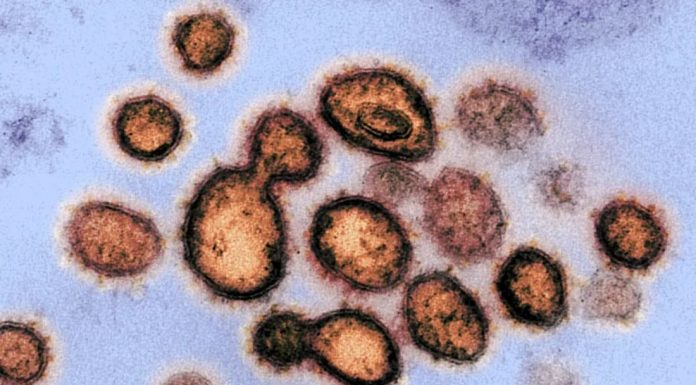 Alterações cerebrais semelhantes às do Alzheimer são achadas em pacientes com Covid longa; entenda