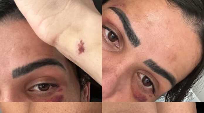 Modelo e influenciadora Amanda Souza é vítima de violência transfóbica na Ilha do Fogo