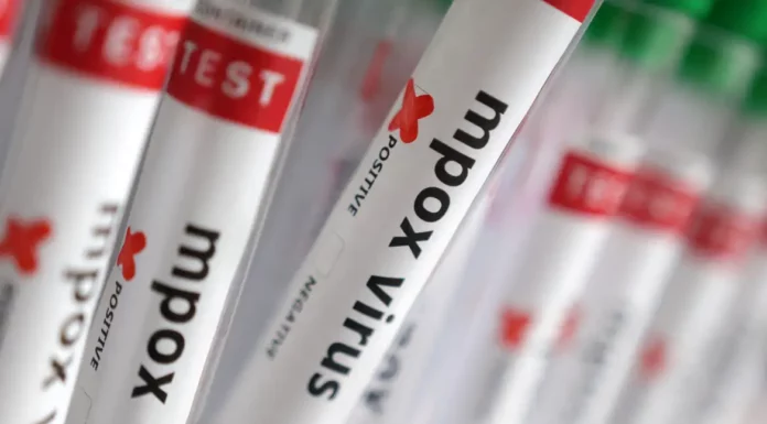 Sobe para 140 número de casos confirmados de Mpox no país, em 2026