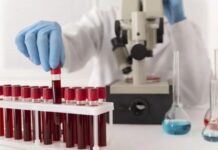 CFM libera tratamento feito com o próprio sangue para lesões e desgaste nas articulações